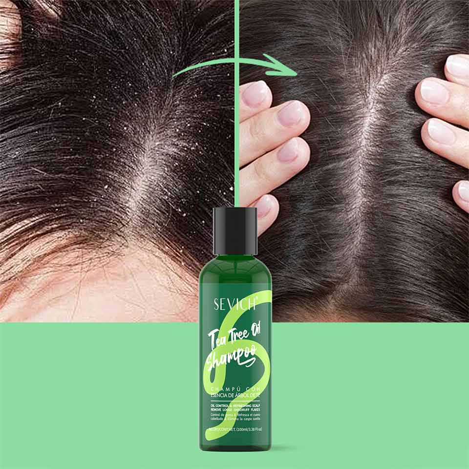 SEVICH Tea Tree Shampoo & Conditioner Set image 2