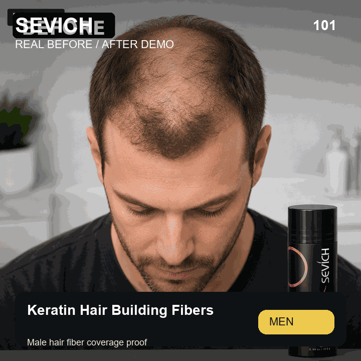 Real male before and after demo for Keratin Hair Building Fibers