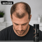 Real male before and after using SEVICH hair building fibers